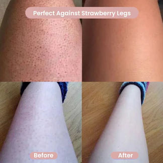 Norexa Body Trimmer 2.0