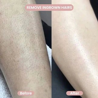 Norexa Body Trimmer 2.0